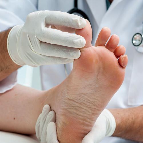 Mobile Foot Care Singapore