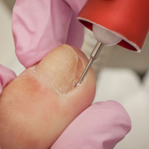 Mobile Foot Care Singapore