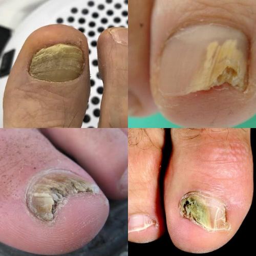 Mobile Foot Care Singapore